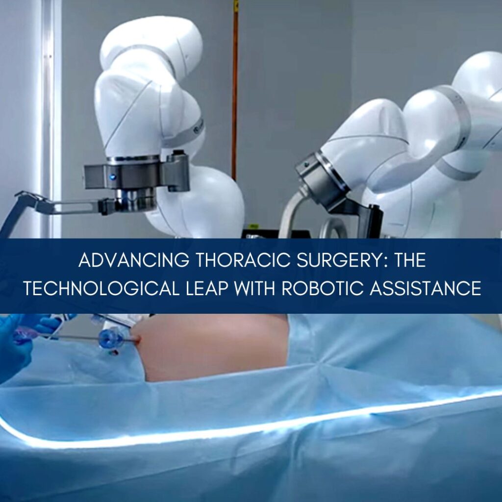 Advancing Thoracic Surgery: The Technological Leap with Robotic Assistance